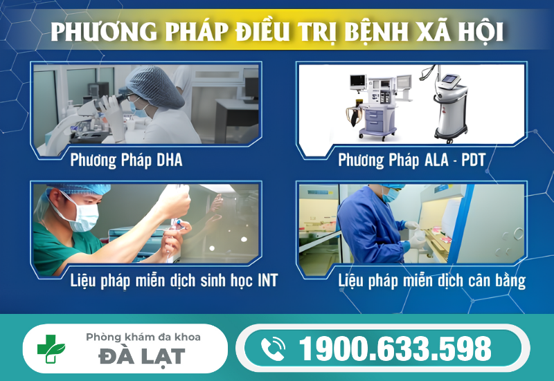 Hình ảnh minh họa